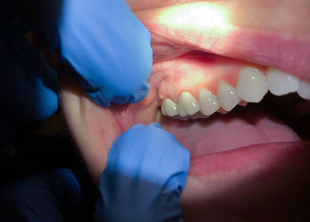 Best Broken or Cracked Tooth Emergency Dentist in Jerome, ID